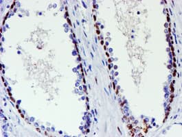WWTR1 / TAZ Antibody (clone OTI1H9)