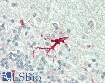IHC-plus™ Polyclonal Rabbit anti-Human DUSP4 / MKP2 Antibody (Internal, IHC, WB)