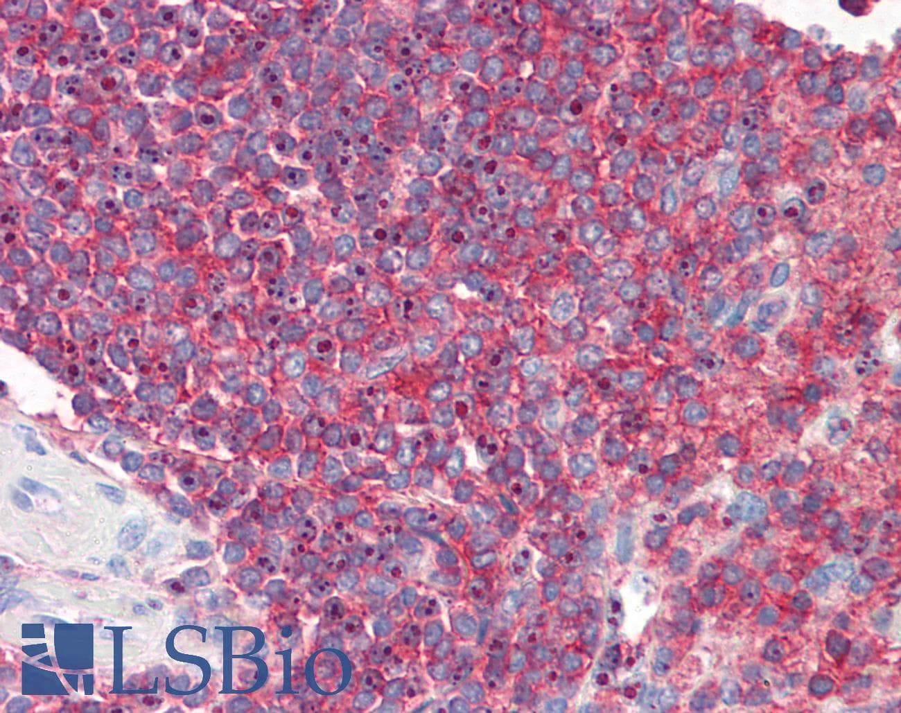 IHC-plus™ Monoclonal Mouse anti-Human ICAM3 / CD50 Antibody (clone 2F8, IHC, WB)