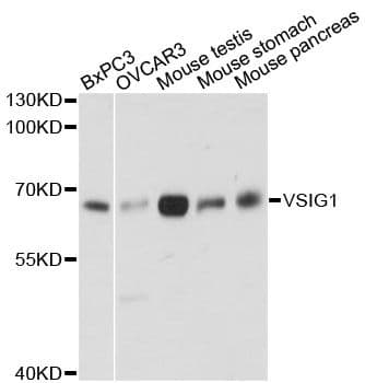 Polyclonal Rabbit anti-Human VSIG1 Antibody (WB)