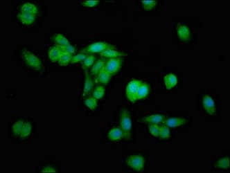 Polyclonal Rabbit anti-Human ERGIC2 Antibody (IHC, IF, WB)