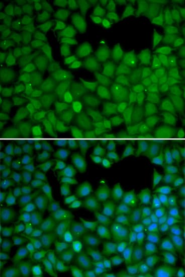NET1 / ARHGEF8 Antibody