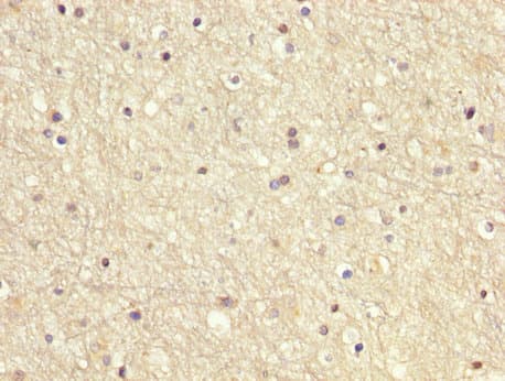 GDI1 Antibody