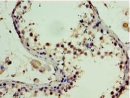 SSSCA1 / p27 Antibody