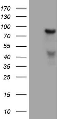 Monoclonal Mouse anti-Human HGF / Hepatocyte Growth Factor Antibody (clone OTI1D2, aa200-494, IHC, WB)