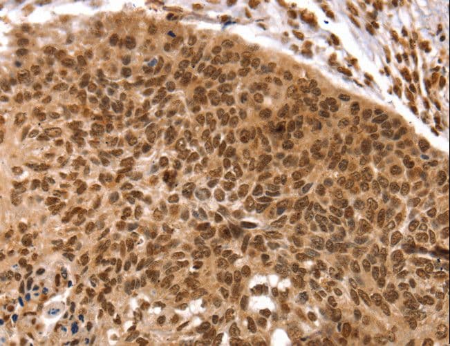 Polyclonal Rabbit anti-Human TAF10 Antibody (IHC, WB)