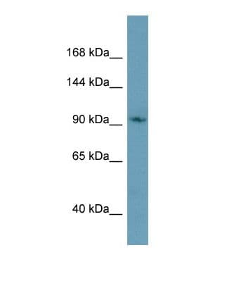 CMTR1 / FTSJD2 Antibody (aa707-756)