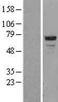 CDKN2AIP Protein (Over-Expression Lysate Myc-DDK (Flag))
