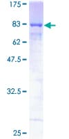 Human HEXIM1 Protein (Recombinant GST)