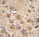 Polyclonal Rabbit anti-Human PCDHAC2 Antibody (aa616-644, IHC, IF, WB)