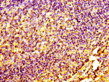 PECAM-1 / CD31 Antibody (clone 9E6E12)