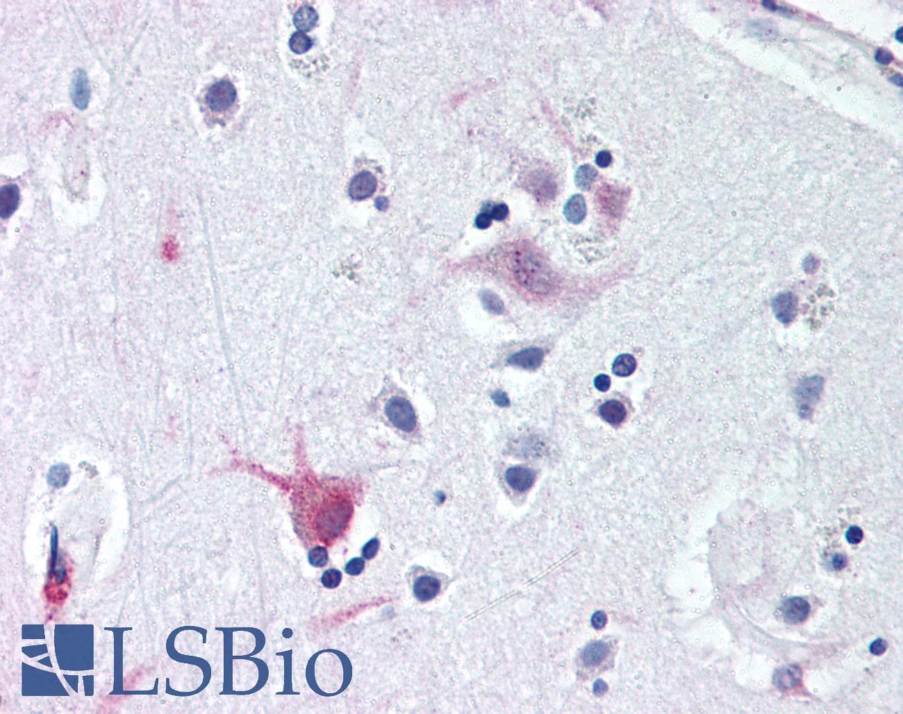 IHC-plus™ WNT8B / Wnt 8b Antibody (C-Terminus)