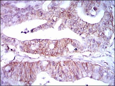 LPA / Lipoprotein a Antibody (Amino Acid: 4330-4521, clone 4H1)