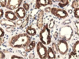 EPHX2 / Epoxide Hydrolase 2 Antibody (clone OTI1A6, Carrier-free)