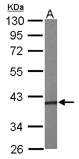 IHC-plus™ PRPSAP1 Antibody (aa1-356)