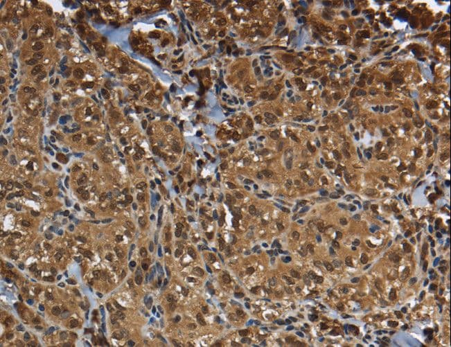 Polyclonal Rabbit anti-Human GLO1 / Glyoxalase I Antibody (IHC, WB)