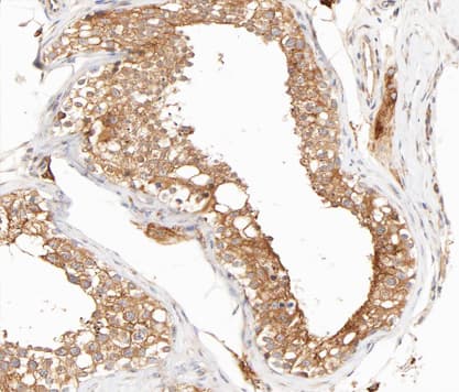 IKBKG / NEMO / IKK Gamma Antibody (phospho-Ser31)