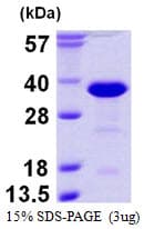 Human RANBP1 Protein (Recombinant His)