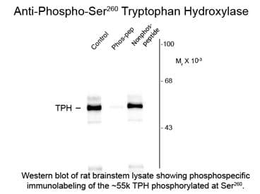Polyclonal Rabbit anti-Rat TPH / Tryptophan Hydroxylase Antibody (phospho-Ser260, WB)