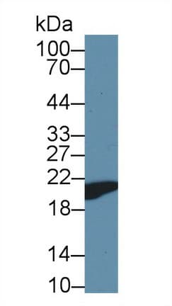 PPIB / Cyclophilin B Antibody (aa34-216, Biotin)