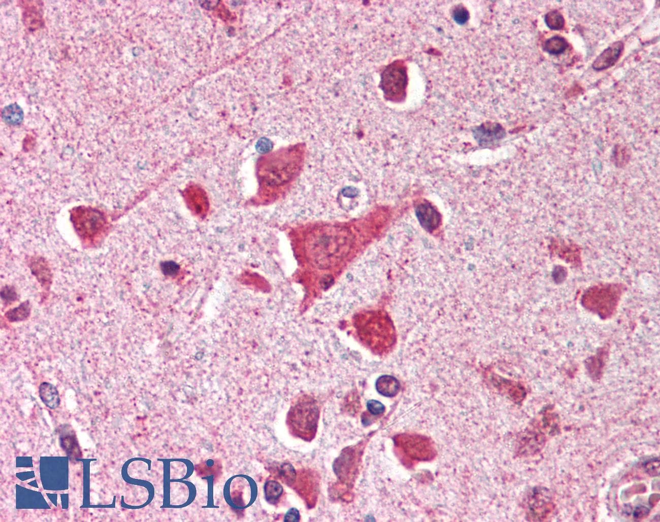 IHC-plus™ TP53 / p53 Antibody (clone BP53-12)