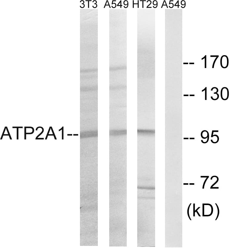 IHC-plus™ ATP2A1 / SERCA1 Antibody (aa548-597)