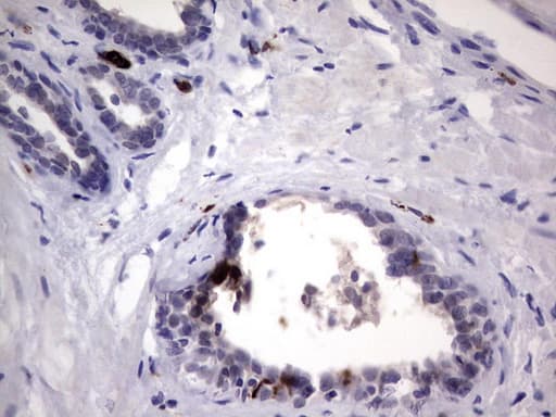 S100A9 / MRP14 Antibody (clone OTI8G1)