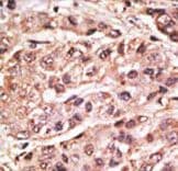 SUMO4 Antibody