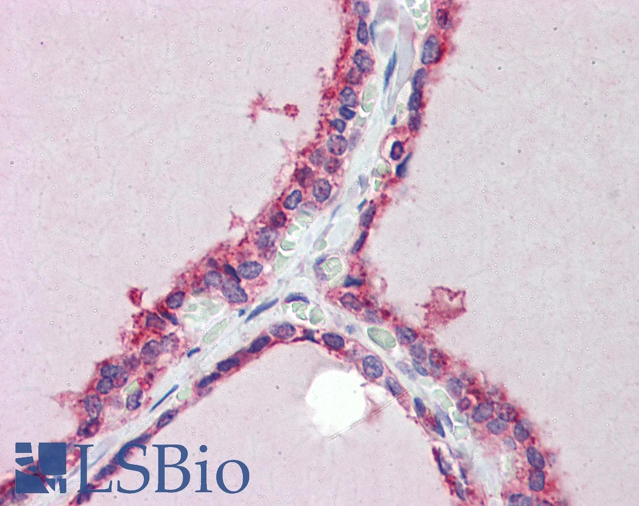 Polyclonal Rabbit anti-Human TRIM8 / GERP Antibody (aa36-85, IHC, WB)