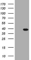 KLK8 / Kallikrein 8 Antibody (clone OTI3E6)