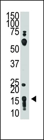 IHC-plus™ Polyclonal Rabbit anti-Human THY1 / CD90 Antibody (aa36-65, IHC, WB)