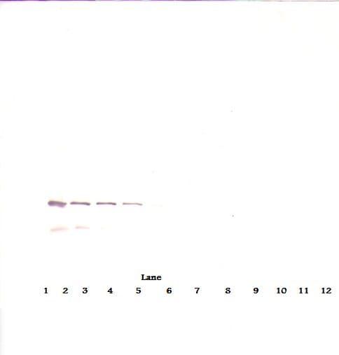 IHC-plus™ IGFBP7 / TAF Antibody