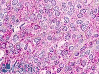 PathPlus™ CHEMR23 / CMKLR1 Antibody (N-Terminus)