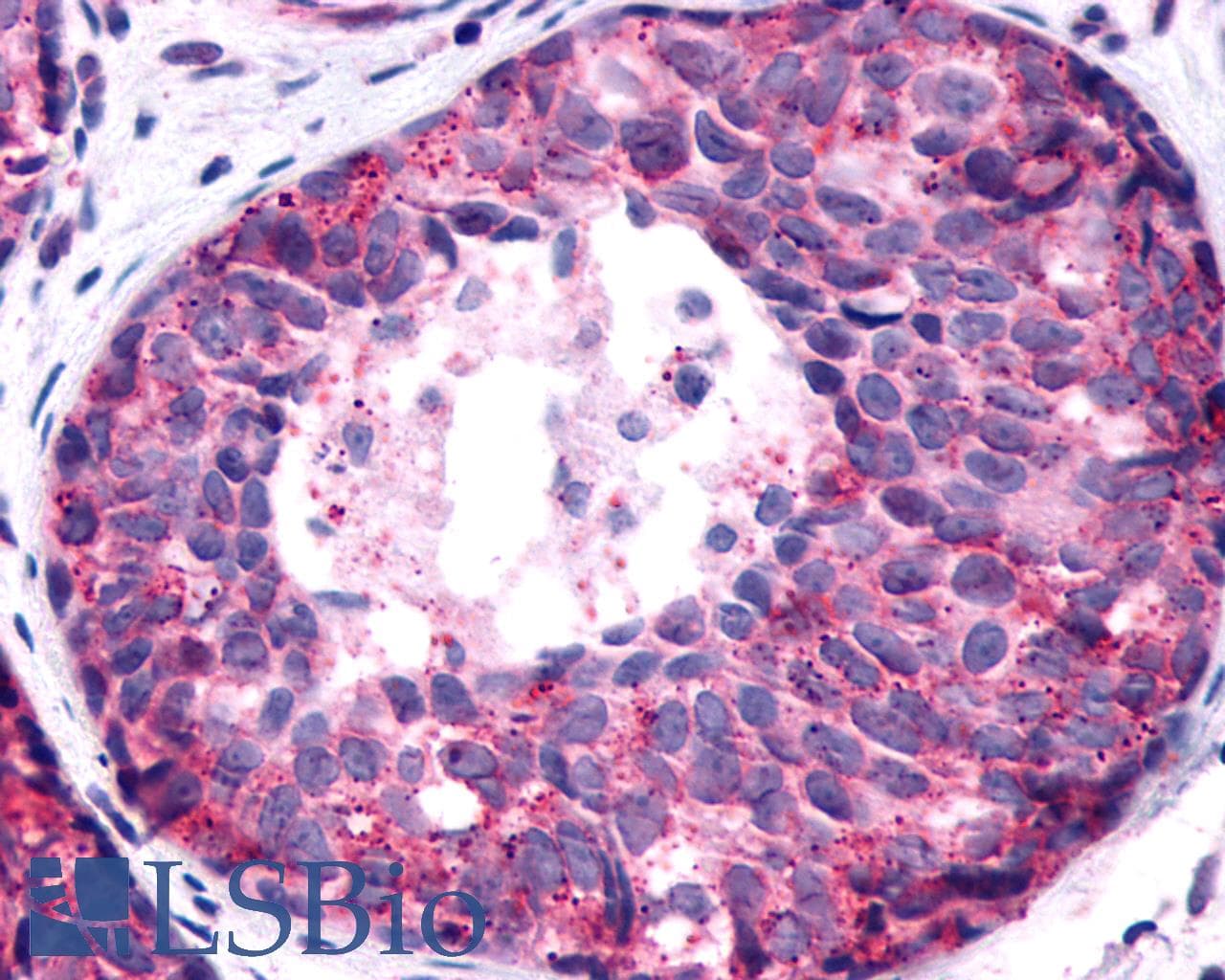 PathPlus™ Polyclonal Rabbit anti-Human F2RL1 / PAR2 Antibody (C-Terminus, IHC)