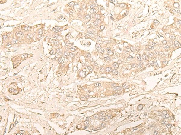 DIMT1L Antibody