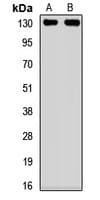 SIRT1 / Sirtuin 1 Antibody