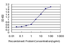 IHC-plus™ RPS2 / Ribosomal Protein S2 Antibody (clone 3G6)
