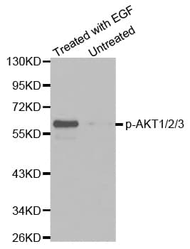 AKT1 + AKT2 + AKT3 Antibody (phospho-Tyr315/316/312)