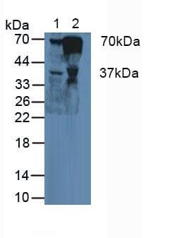 FGA / Fibrinogen Alpha Antibody (aa124-214)