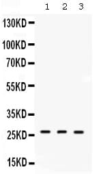 Polyclonal Rabbit anti-Human DDAH2 Antibody (IHC, WB)