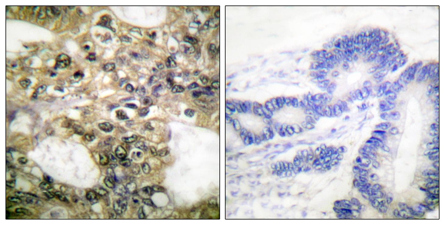 HDAC6 Antibody