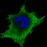SOD1 / Cu-Zn SOD Antibody (clone 6F5)