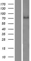 ABLIM3 Protein (Over-Expression Lysate Myc-DDK (Flag))