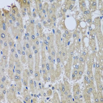 Polyclonal Rabbit anti-Human SYT11 Antibody (IHC, WB)
