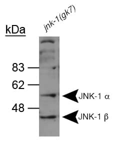 MAPK8 / JNK1 Antibody (aa228-451)