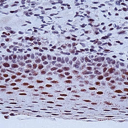 Monoclonal Mouse anti-Human ERCC1 Antibody (clone 8F1, IHC, WB)