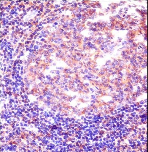 Polyclonal Rabbit anti-Human RBM12 Antibody (aa575-603, IHC, WB)