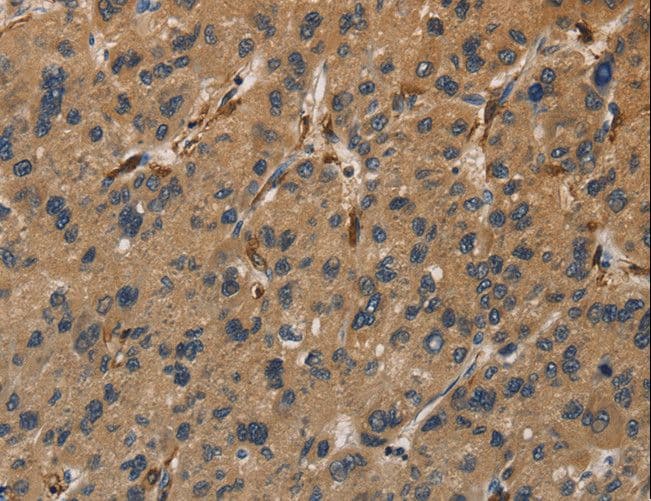UBE2S / E2 EPF Antibody