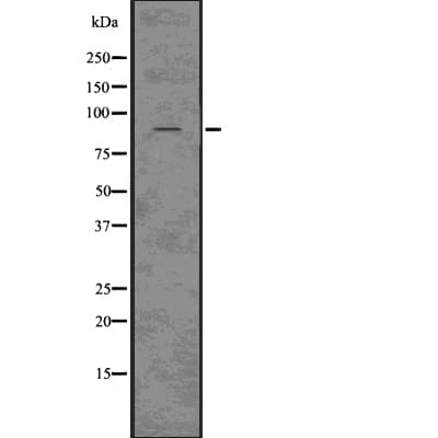 Polyclonal Rabbit anti-Human ClC-3 / CLCN3 Antibody (IHC, WB)