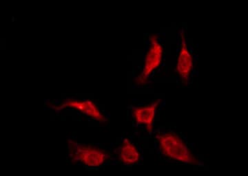 Polyclonal Rabbit anti-Human OR4K14 Antibody (IF, WB)